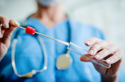 Tıbbi akın örnekleme çubuğunun üretim yöntemi